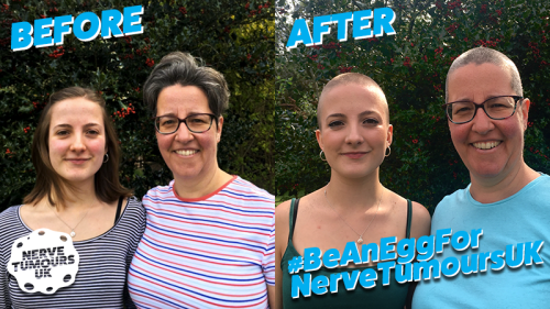 Before & After